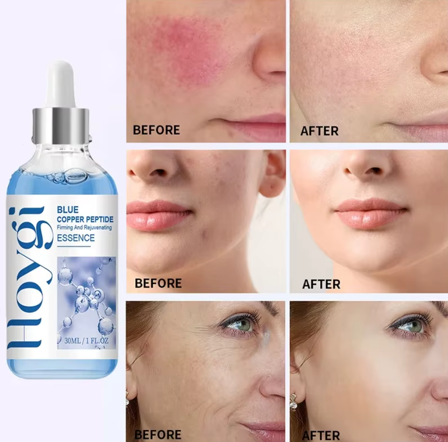 بلو ايسنس سيروم – بشرة ناعمة ومضيئة خلال أيام